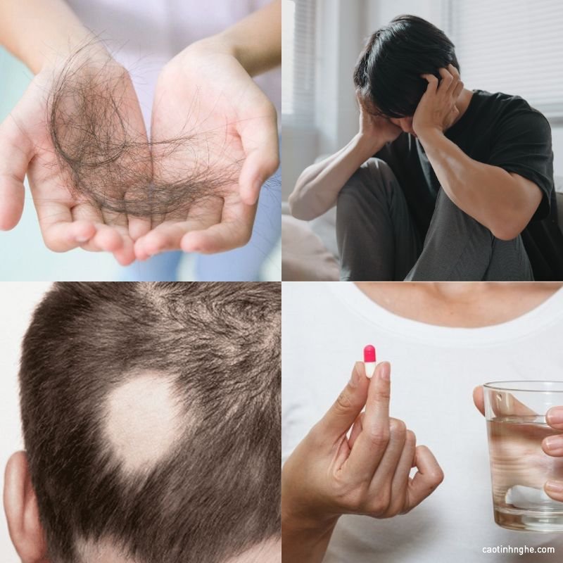 nguyen nhan toc yeu gay rung